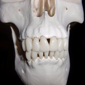 Rafforza ossa e denti - cavolo